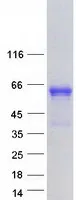 EBF2 (NM_022659) Human Recombinant Protein - image 1