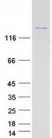 ASPP1 (PPP1R13B) (NM_015316) Human Recombinant Protein - image 1