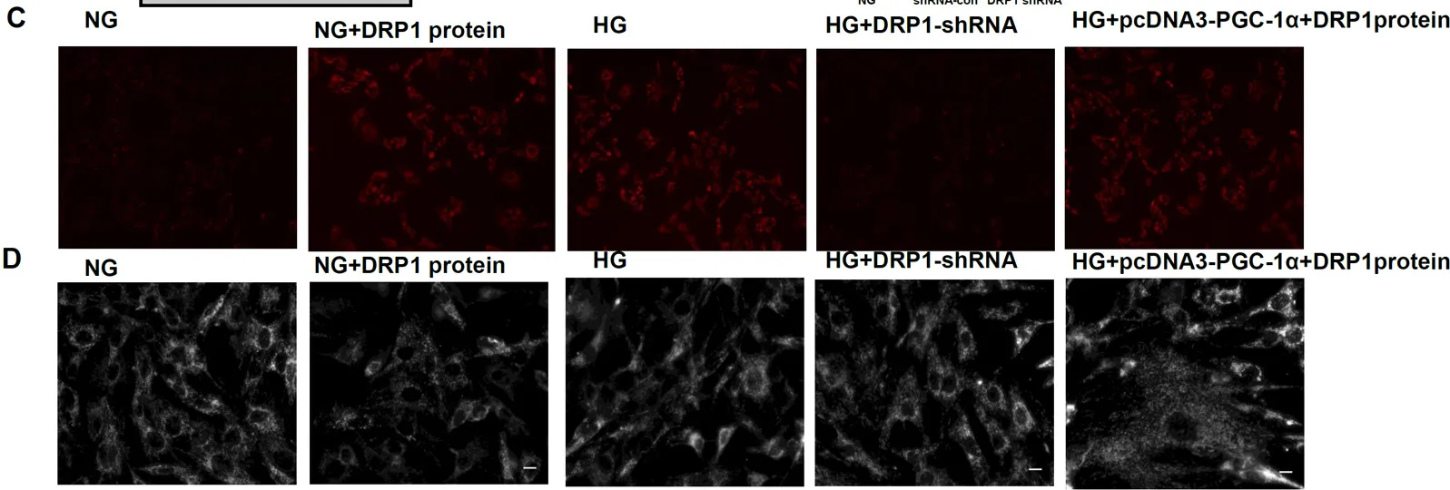 DRP1 (DNM1L) (NM_012062) Human Recombinant Protein - image 1