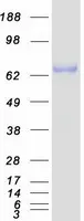 RUNX1T1 (NM_175635) Human Recombinant Protein - image 1