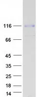 MCK10 (DDR1) (NM_013994) Human Recombinant Protein - image 1