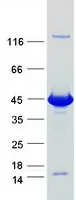 DHPS (NM_013407) Human Recombinant Protein - image 1