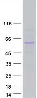TTC39B (NM_152574) Human Recombinant Protein - image 1