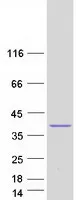 LDB3 (NM_001080116) Human Recombinant Protein - image 1