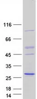 NKIRAS2 (NM_001001349) Human Recombinant Protein - image 1