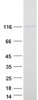 TLL1 (NM_012464) Human Recombinant Protein - image 1