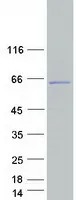 CCDC83 (NM_173556) Human Recombinant Protein - image 1
