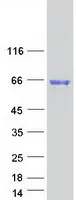 ARSL (NM_000047) Human Recombinant Protein - image 1