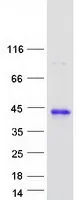 HCCS (NM_001122608) Human Recombinant Protein - image 1
