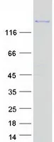 NTE (PNPLA6) (NM_001166111) Human Recombinant Protein - image 1