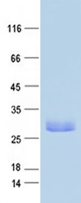 Wfdc2 (BC099427) Mouse Recombinant Protein - image 1