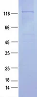 Nos2 (NM_010927) Mouse Recombinant Protein - image 1