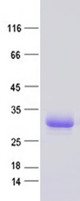 Apod (NM_007470) Mouse Recombinant Protein - image 1