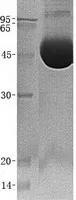 CHIT1 (NM_003465) Human Recombinant Protein - image 1