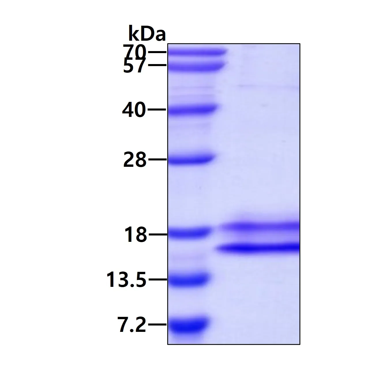 Il17a Mouse Recombinant Protein - image 1