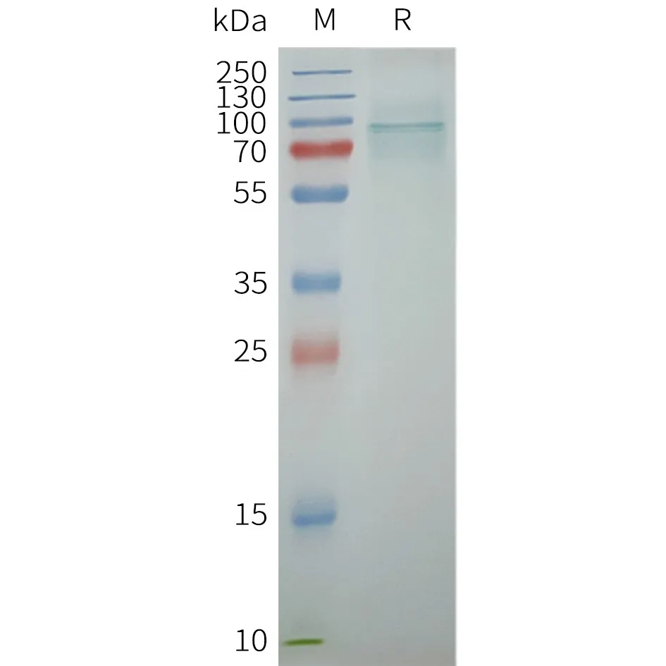 TRPV6 Human Recombinant Protein, Synthetic Nanodisc - image 1