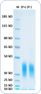 Human Recombinant Protein - image 1