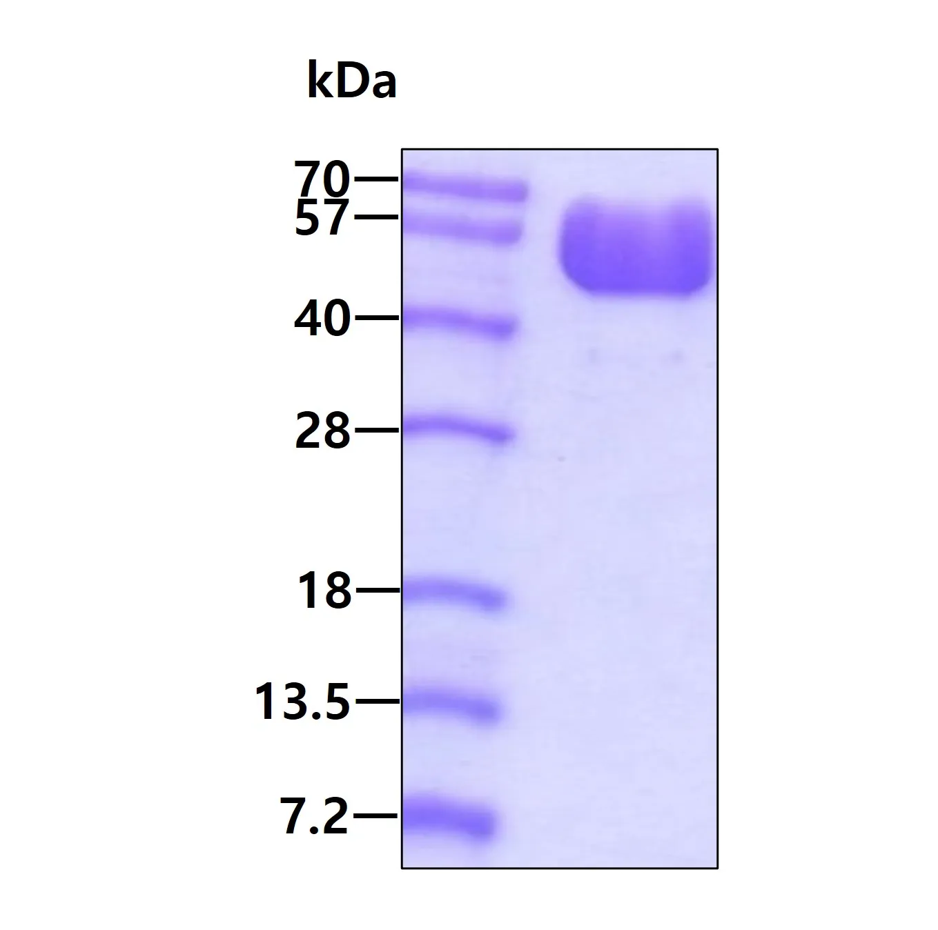 TMIGD2 (23-150, hIgG-Tag) Human Recombinant Protein - image 1