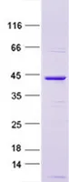 TDT (Dntt) (NM_001043228) Mouse Recombinant Protein - image 1