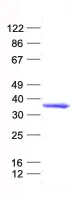 TGIF (TGIF1) (NM_173208) Human Recombinant Protein - image 1