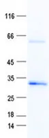 ECHDC2 (NM_018281) Human Recombinant Protein - image 1