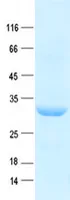 DDB2 (NM_000107) Human Recombinant Protein - image 1