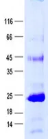 TIMP3 (NM_000362) Human Recombinant Protein - image 1