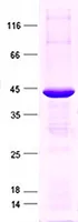 Complement Component 6 (C6) (NM_000065) Human Recombinant Protein - image 1