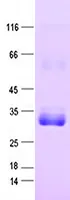 TRPC6 (NM_004621) Human Recombinant Protein - image 1