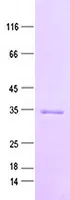 CelluLar Apoptosis Susceptibility (CSE1L) (NM_001316) Human Recombinant Protein - image 1