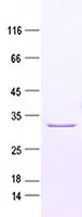 Aurora A (AURKA) (NM_198435) Human Recombinant Protein - image 1