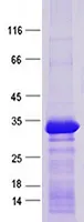 TOPBP1 (NM_007027) Human Recombinant Protein - image 1