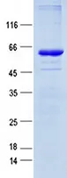 RSPO1 (NM_001038633) Human Recombinant Protein - image 1