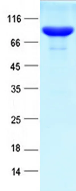 RNase R E.coli Recombinant Protein - image 1