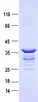 CD23 (FCER2) (NM_002002) Human Recombinant Protein - image 1