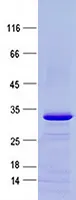 CD64 (FCGR1A) (NM_000566) Human Recombinant Protein - image 1