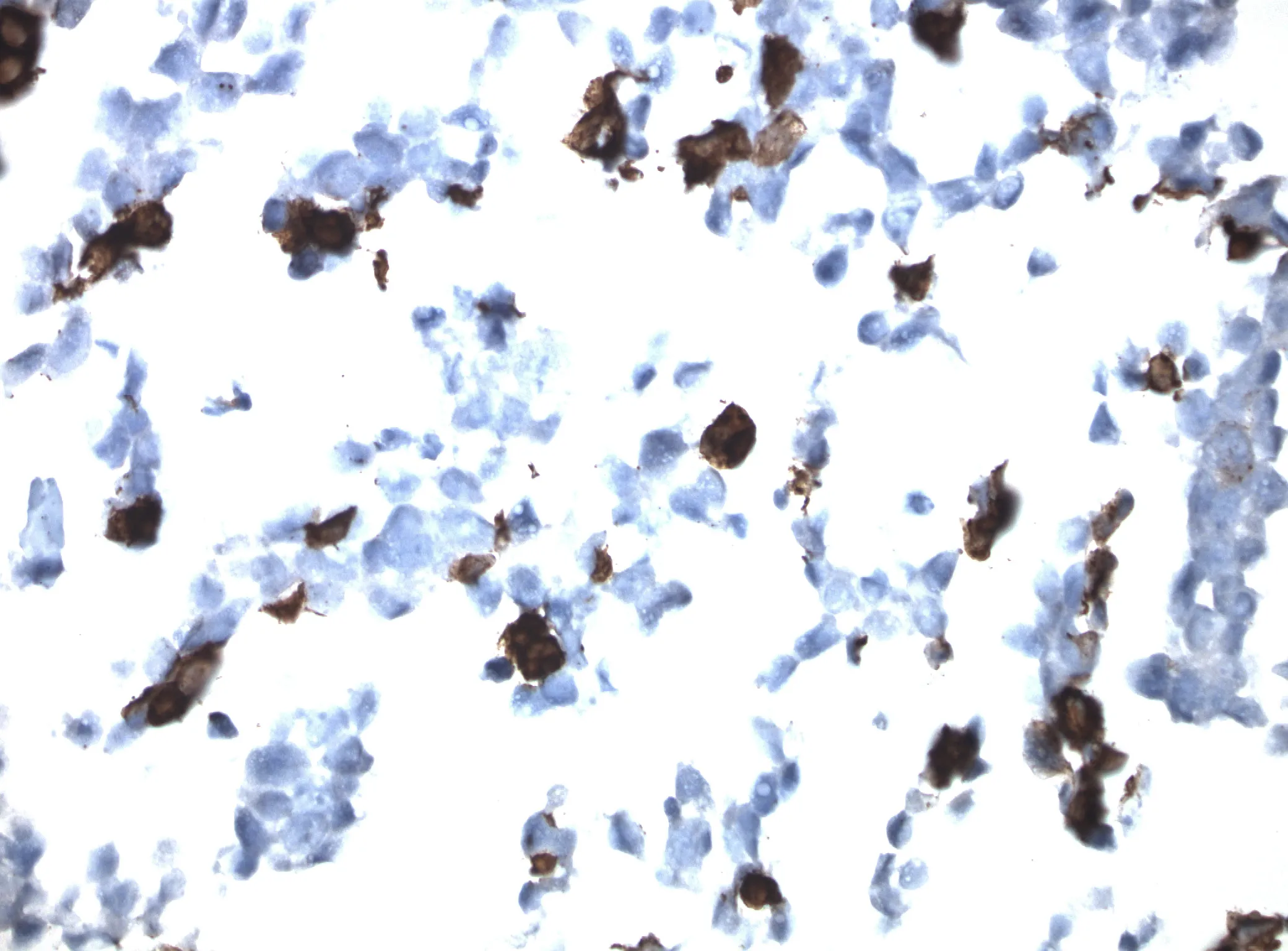 CD68 CytoSection - image 1