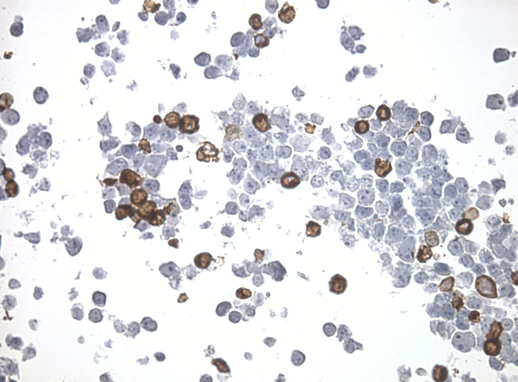 SNRNP40 CytoSection - image 1