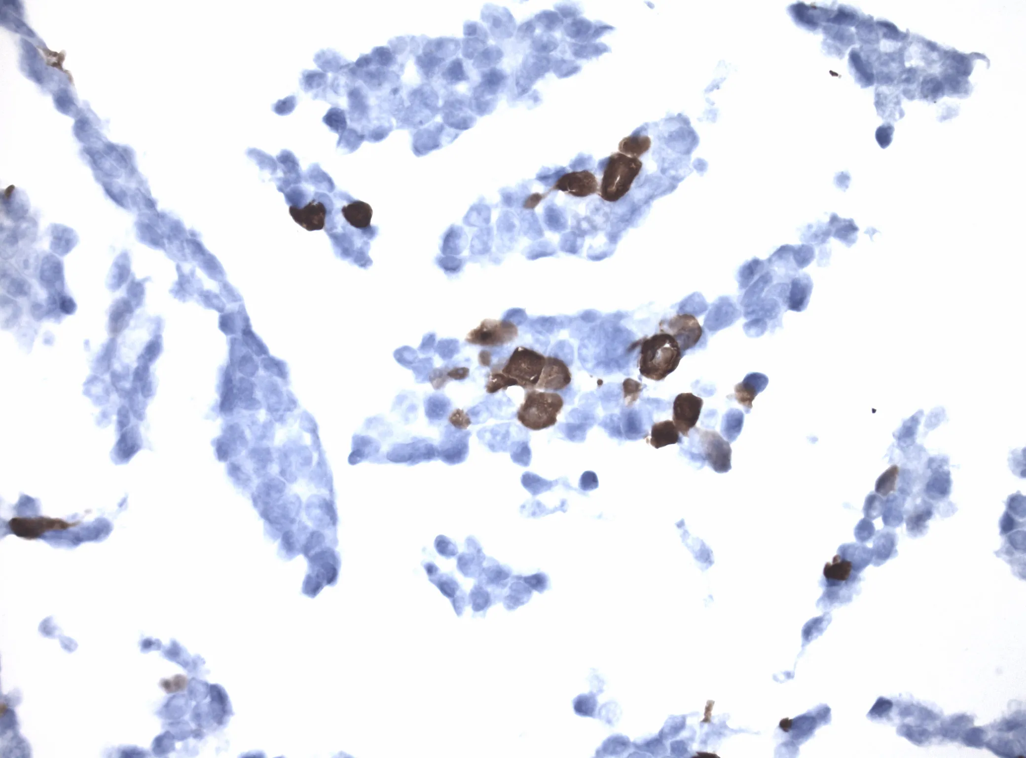 MAGEA8 CytoSection - image 1