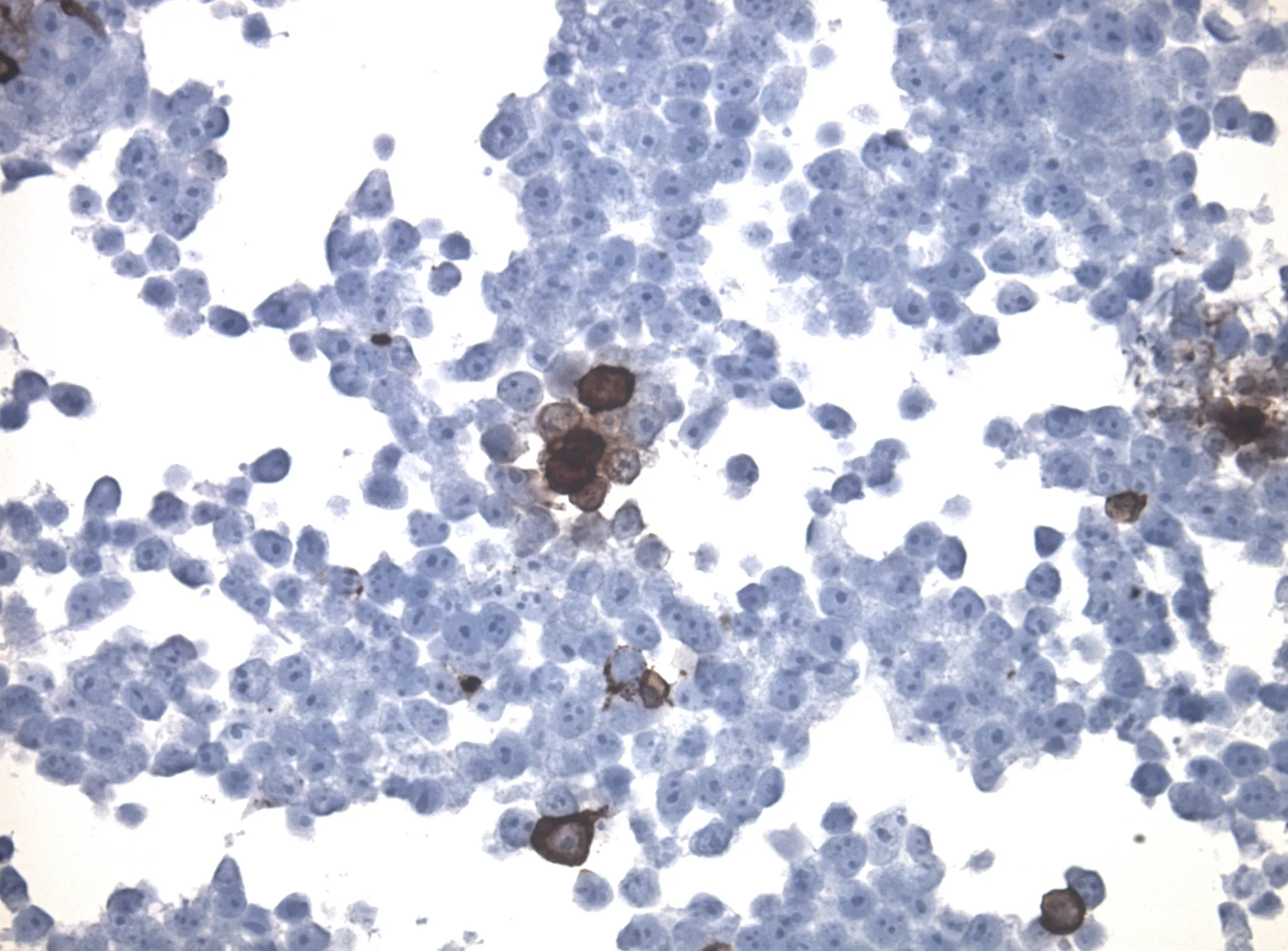 Myelin Basic Protein (MBP) CytoSection - image 1