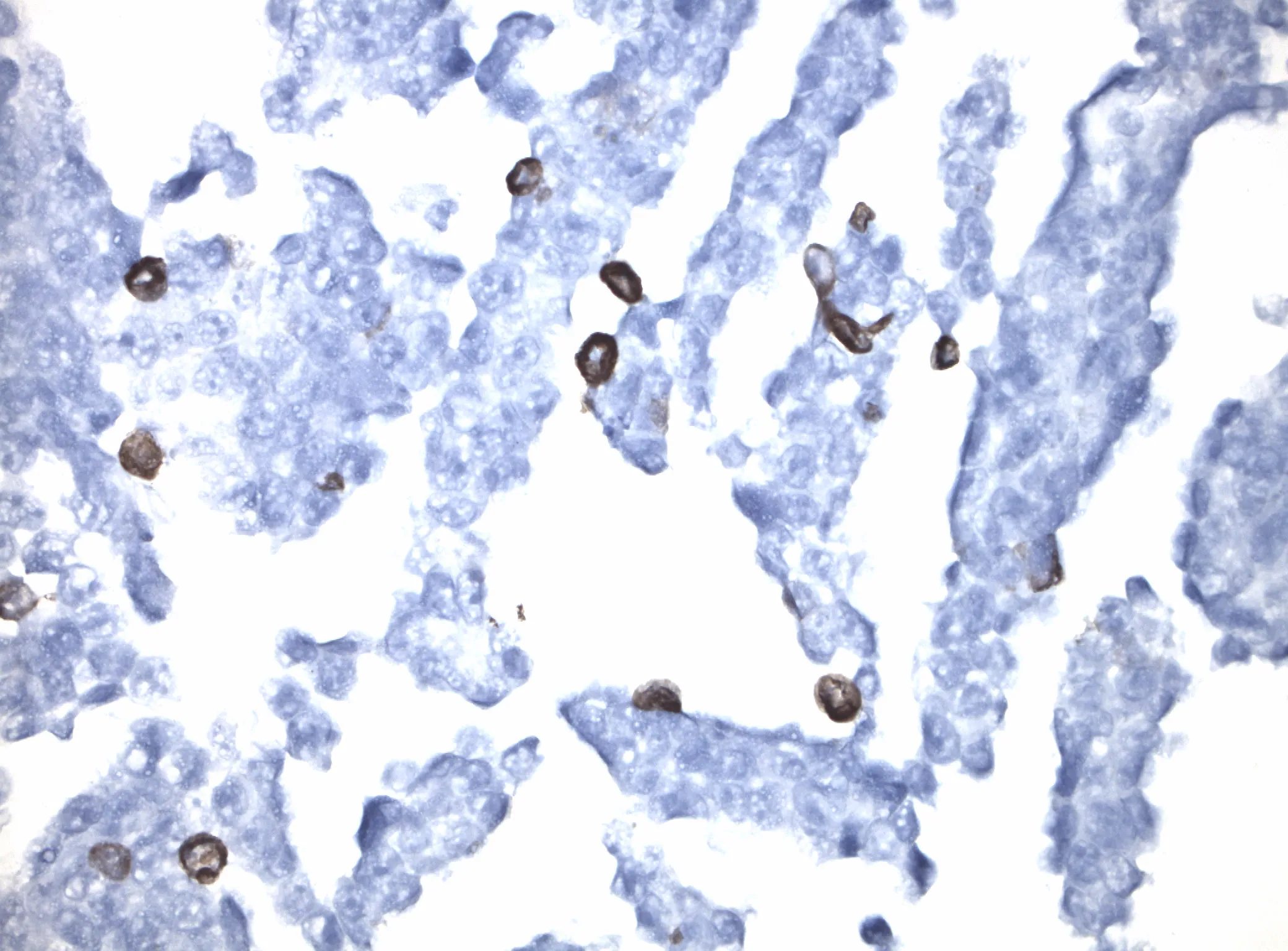 Nogo Receptor (RTN4R) CytoSection - image 1