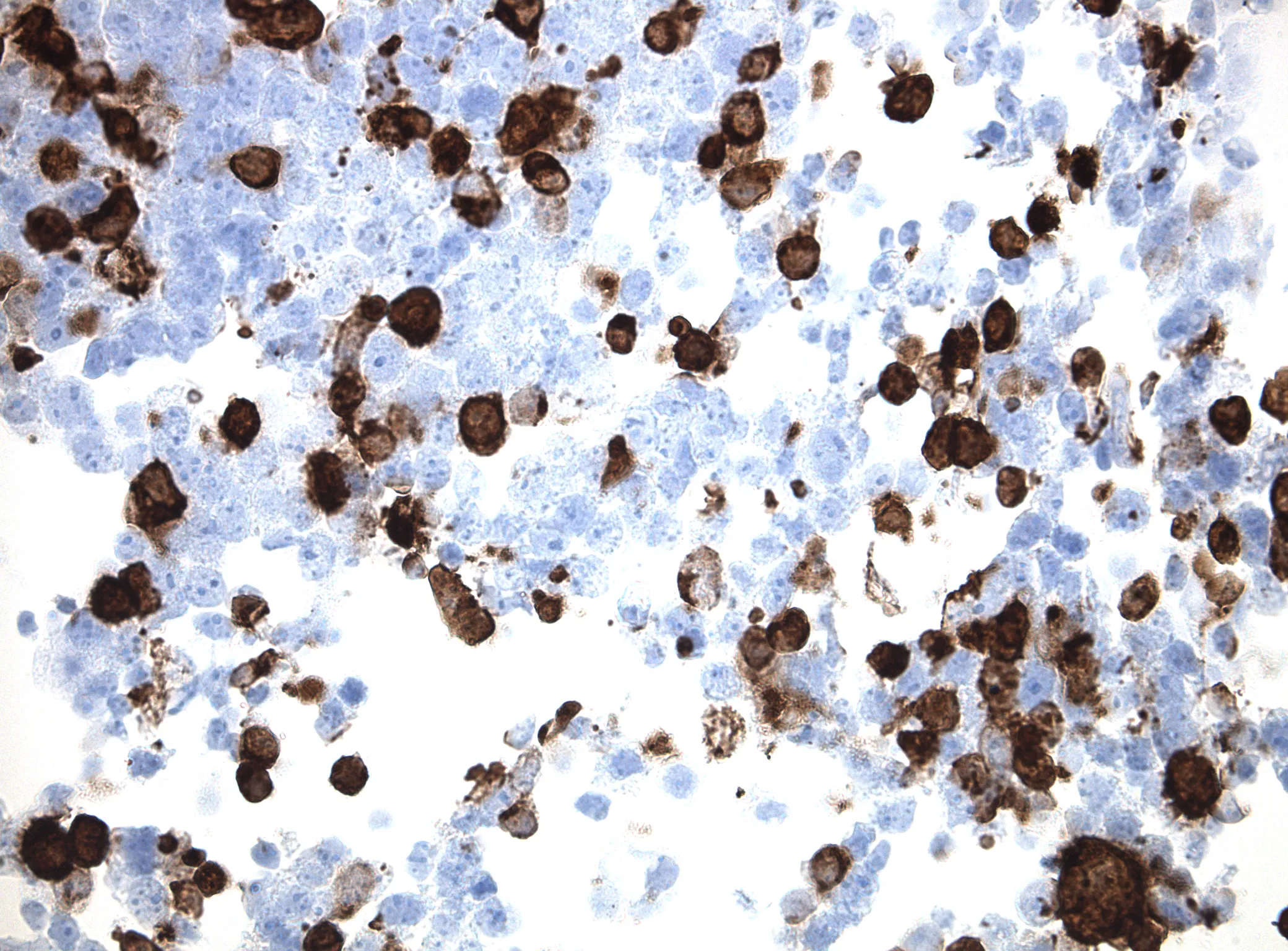 IL11 CytoSection - image 1