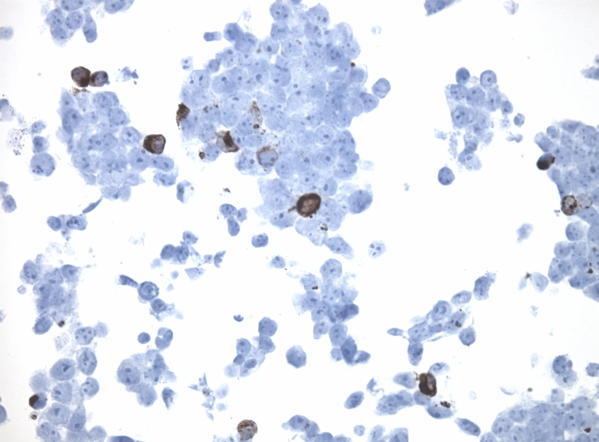 CIDE B (CIDEB) CytoSection - image 1