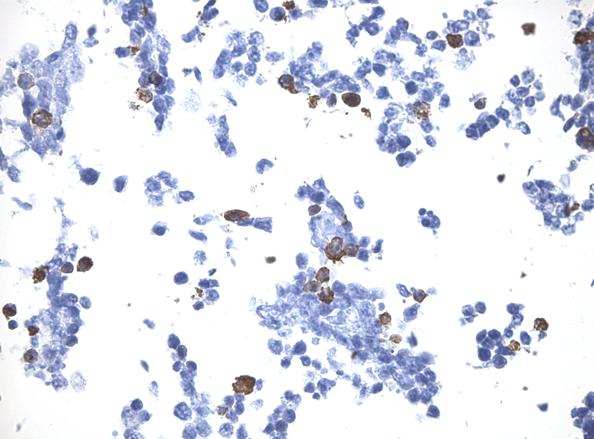 ALOX15 CytoSection - image 1