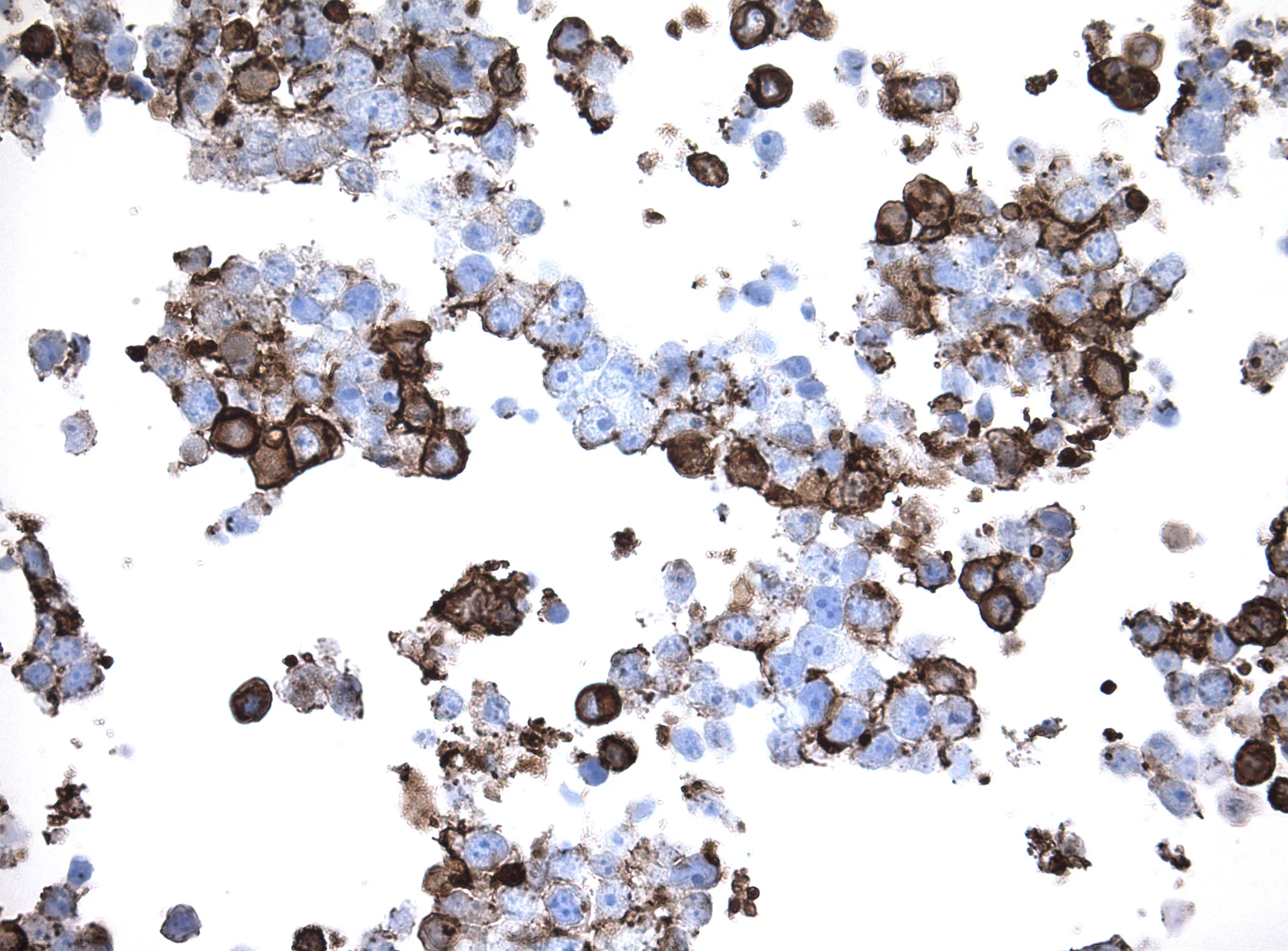 TNF alpha (TNF) CytoSection - image 1