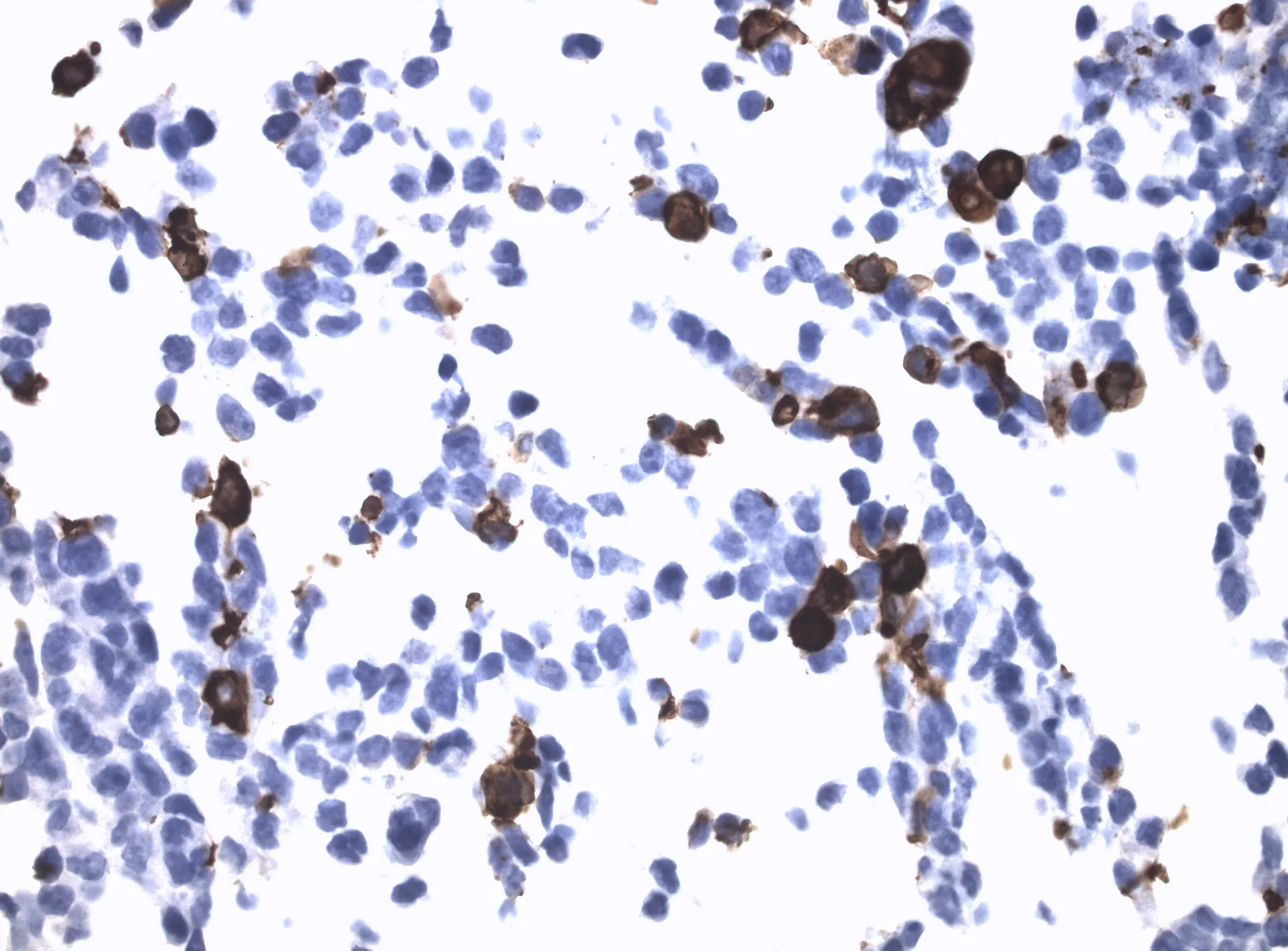 CCR1 CytoSection - image 1