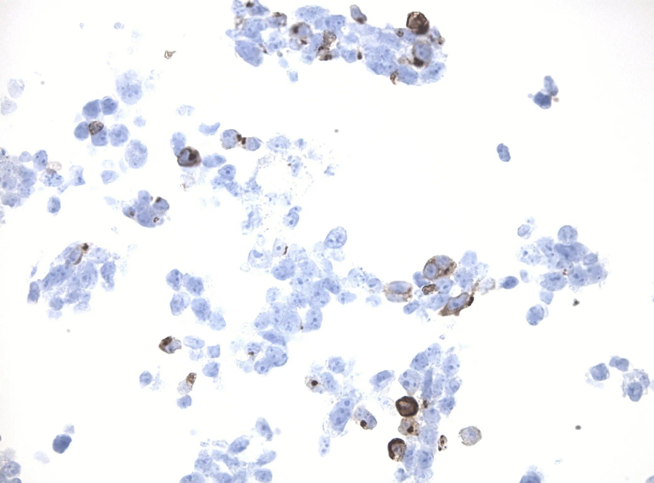 IL17F CytoSection - image 1