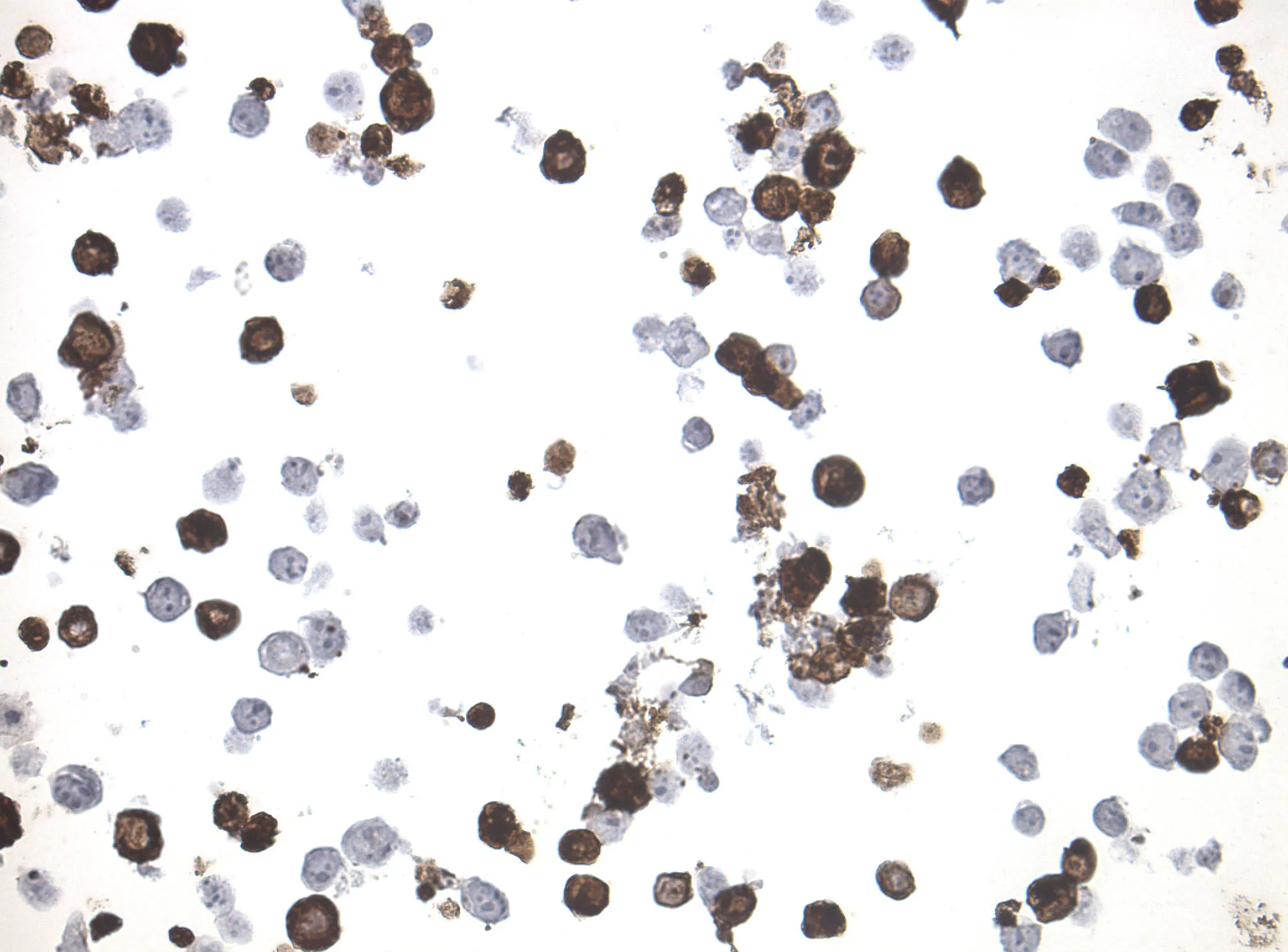 PCDHA4 CytoSection - image 1