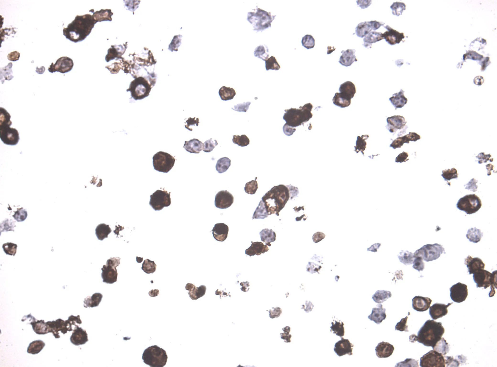 Her2 (ERBB2) CytoSection - image 1
