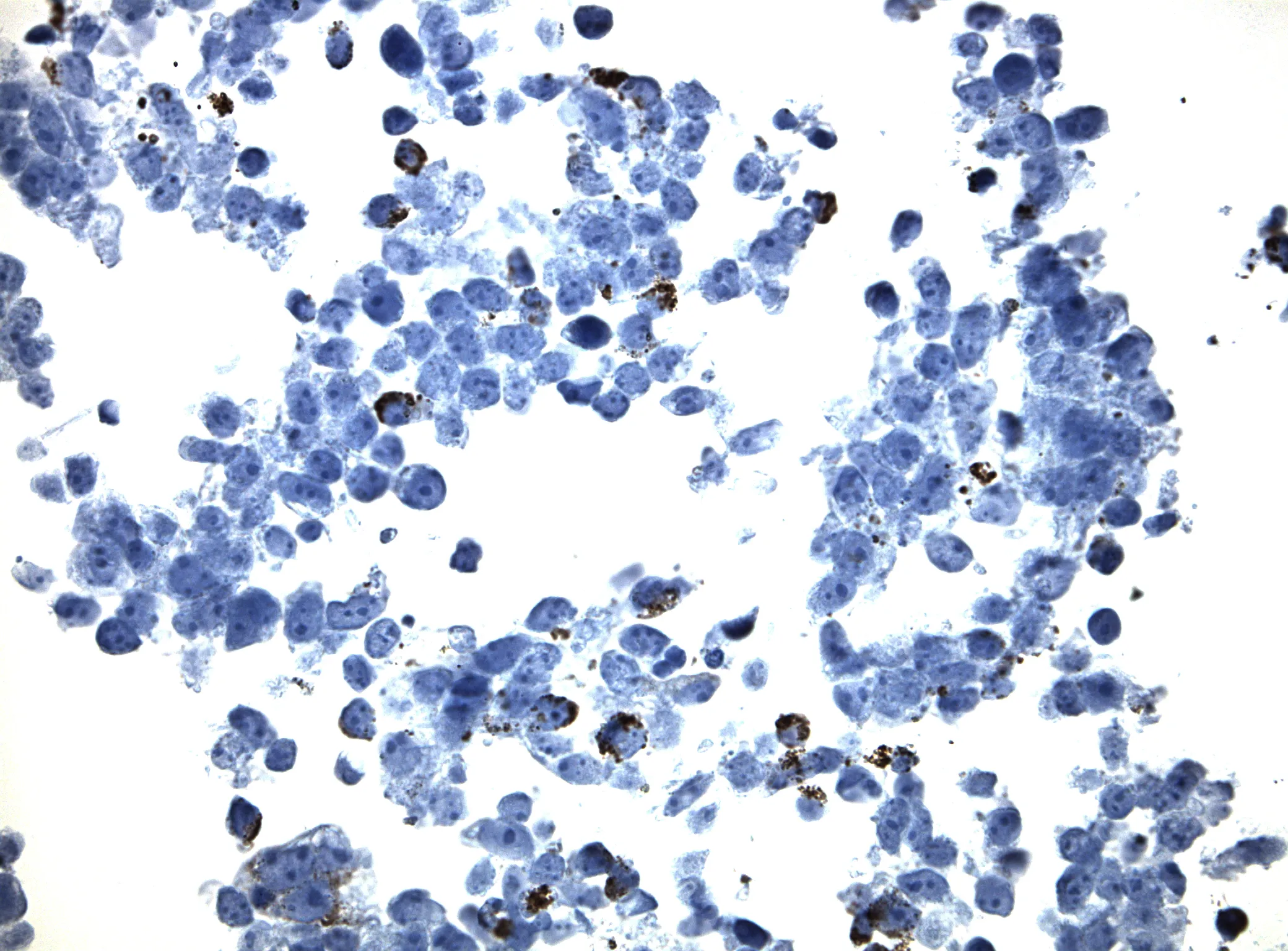 CLEC12A CytoSection - image 1